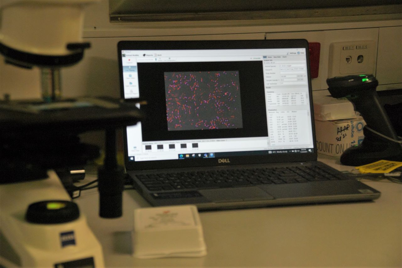 Coral sperm is viewed under microscope using specialised computer programs to assess activation. 